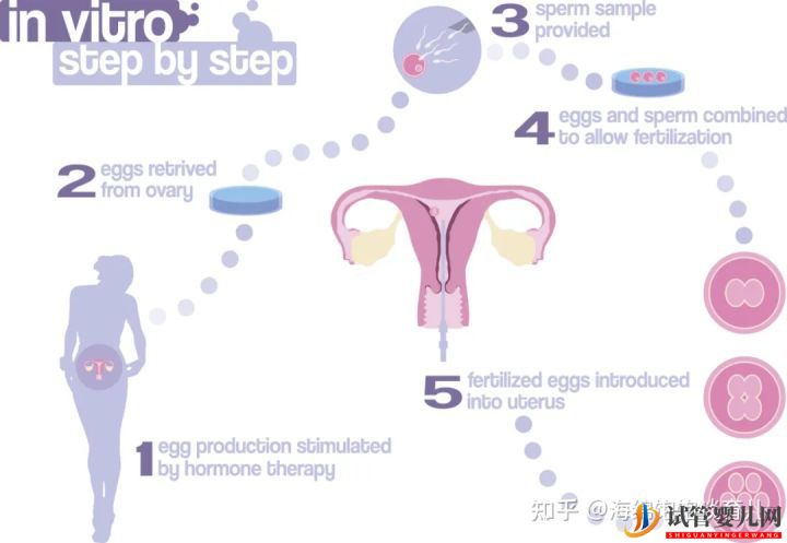 試管嬰兒1代、2代、3代、4代哪個最好(圖1)