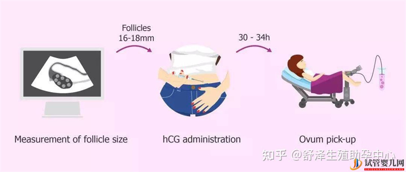 一個試管嬰兒周期多長時間,具體流程怎么樣(圖5)