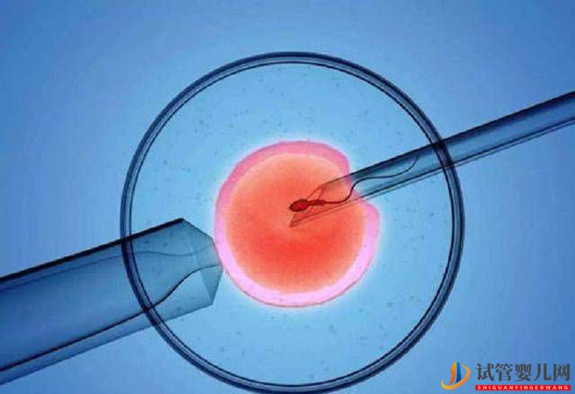 試管嬰兒和普通嬰兒,有什么區(qū)別?并非壽命和智商,差的只有這個(gè)(圖2) 試管嬰兒和普通嬰兒,有什么區(qū)別?并非壽命和智商,差的只有這個(gè)(圖2)
