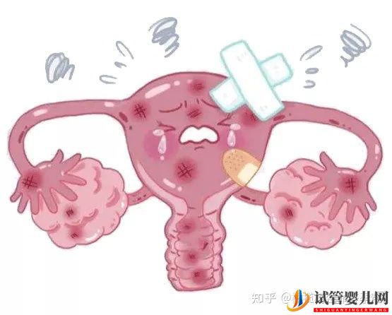 全面!試管嬰兒必查項目「性激素六項」報告數值逐個(圖16) 試管嬰兒必查項目性激素六項報告數值逐個(圖7)