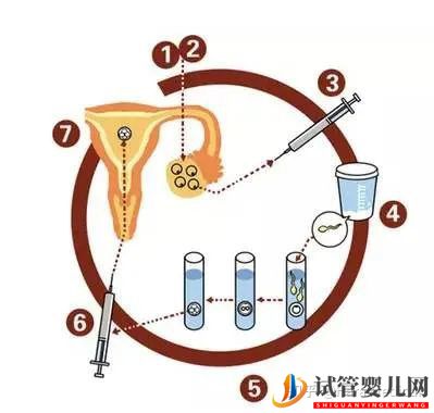 取卵究竟疼不疼呢_聽聽原孕中心的專家們怎么說(圖3) 取卵究竟疼不疼呢_聽聽原孕中心的專家們怎么說(圖3)