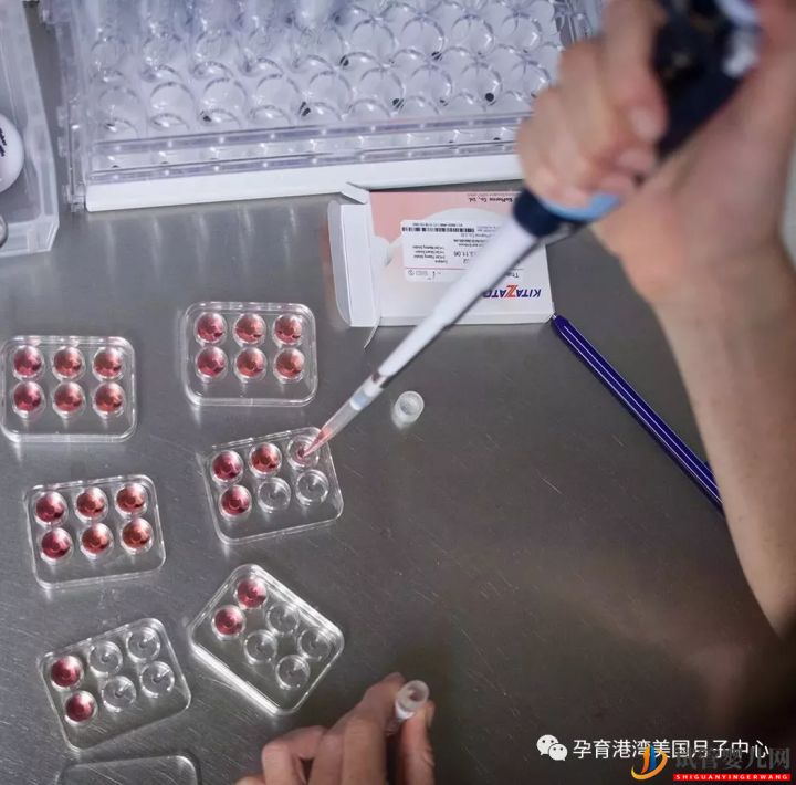 試管嬰兒技術,美國vs中國(圖8) 試管嬰兒技術,美國vs中國(圖4)