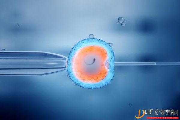 美國試管嬰兒技術(shù)剖析-六個環(huán)節(jié)操作細(xì)節(jié)解讀(圖3) 美國試管嬰兒技術(shù)剖析-六個環(huán)節(jié)操作細(xì)節(jié)解讀(圖2)