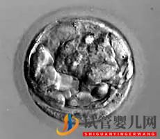 美國試管嬰兒_這樣的囊胚才是極好的(圖7) 美國試管嬰兒_這樣的囊胚才是極好的(圖7)