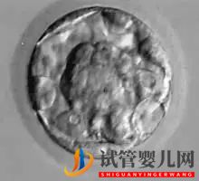 美國試管嬰兒_這樣的囊胚才是極好的(圖10) 美國試管嬰兒_這樣的囊胚才是極好的(圖10)