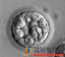 美國試管嬰兒_這樣的囊胚才是極好的(圖12) 美國試管嬰兒_這樣的囊胚才是極好的(圖12)
