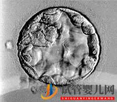 美國試管嬰兒_這樣的囊胚才是極好的(圖17) 美國試管嬰兒_這樣的囊胚才是極好的(圖17)