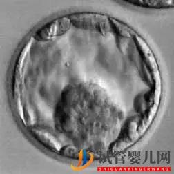 美國試管嬰兒_這樣的囊胚才是極好的(圖22) 美國試管嬰兒_這樣的囊胚才是極好的(圖22)