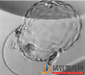 美國試管嬰兒_這樣的囊胚才是極好的(圖25) 美國試管嬰兒_這樣的囊胚才是極好的(圖25)