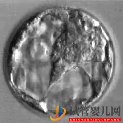 美國試管嬰兒_這樣的囊胚才是極好的(圖23) 美國試管嬰兒_這樣的囊胚才是極好的(圖23)