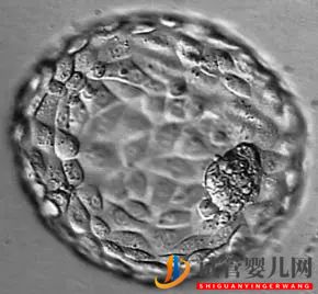 美國試管嬰兒_這樣的囊胚才是極好的(圖28) 美國試管嬰兒_這樣的囊胚才是極好的(圖28)