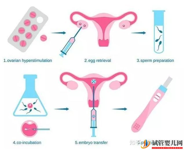 試管嬰兒多少錢一次_一般的工薪家庭能做嗎(圖1)
