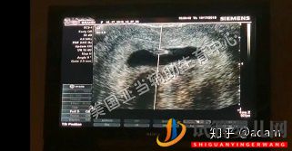 試管嬰兒寶寶VS自然受孕寶寶(圖1)