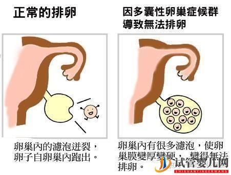 試管嬰兒成功誕生有多難(圖6)