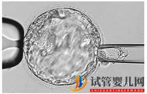 第三代試管嬰兒真的最好最先進嗎_國內(nèi)哪里可以做(圖5)
