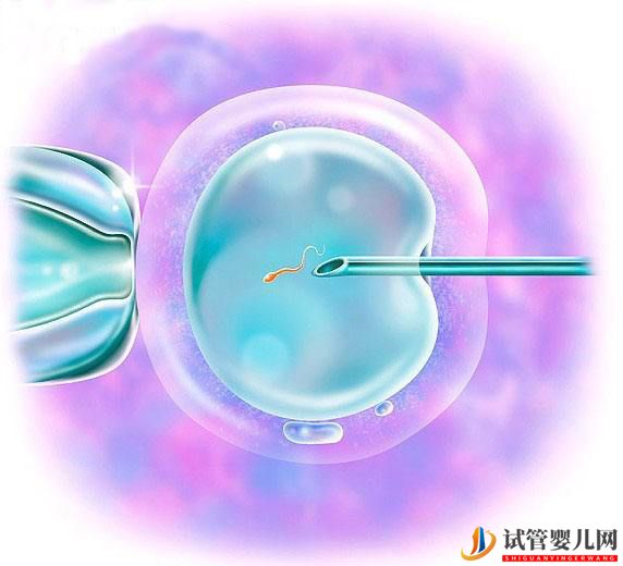 第三代試管嬰可以排除染色體異常嗎(圖1)