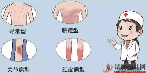 恭喜你，出現(xiàn)這些跡象，說(shuō)明你的銀屑病正在好轉(zhuǎn)！(圖1)
