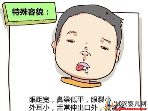 試管嬰兒網(wǎng):頭胎是唐氏兒,二胎備孕怎么預防唐氏?做三代試管可以預防嗎?(圖2) 頭胎是唐氏兒,二胎備孕怎么預防唐氏?做三代試管可以預防嗎?(圖1)