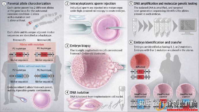 試管嬰兒網:無家族遺傳病史的夫妻有必要做第三代試管(圖7) 無家族遺傳病史的夫妻有必要做第三代試管(圖4)