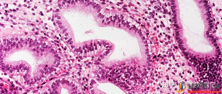 人工雙胞胎的費用多少,雙胞胎的幾率有多大(圖3)