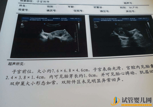 試管移植41天查不出胎心胎芽？謹防胎停育！(圖1)
