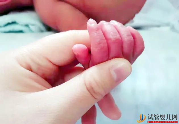 試管嬰兒雙胞胎龍鳳胎的概率(試管嬰兒費用大概要多少錢)(圖2) 試管嬰兒雙胞胎龍鳳胎的概率(圖1)