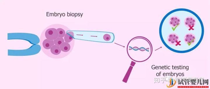 關于美國試管嬰兒技術的問題一網打盡(試管嬰兒多少錢)(圖8) 關于美國試管嬰兒技術的問題一網打盡(圖4)