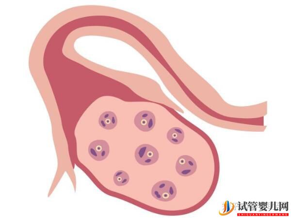 赴美試管嬰兒要經歷哪些流程呢-夢美(試管嬰兒多少錢)(圖6) 赴美試管嬰兒要經歷哪些流程呢(圖3)