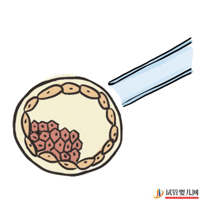 赴美試管嬰兒要經歷哪些流程呢-夢美(試管嬰兒多少錢)(圖12) 赴美試管嬰兒要經歷哪些流程呢(圖6)