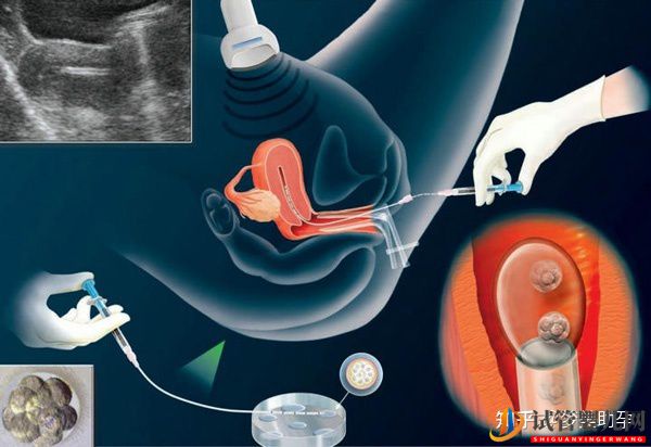 大齡女性去美國試管嬰兒成功率高嗎(試管嬰兒多少錢)(圖15) 大齡女性去美國試管嬰兒成功率高嗎(圖8)