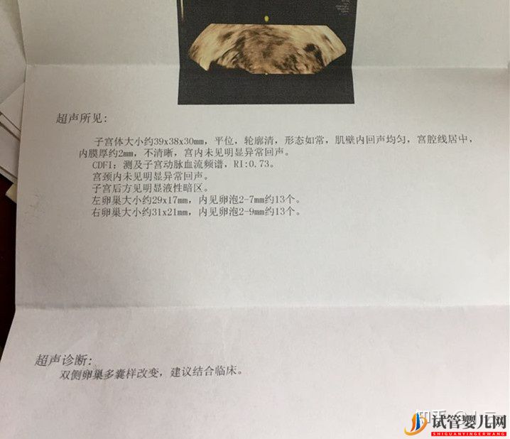 國內第三代試管嬰兒到底能不能選男女(圖1)