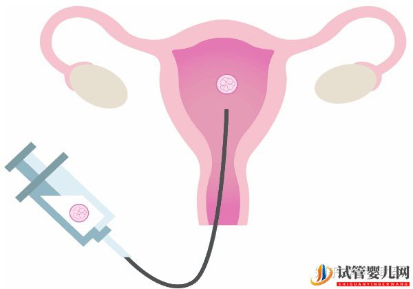 為什么會(huì)發(fā)生早產(chǎn)美國試管嬰兒會(huì)早產(chǎn)嗎(試管嬰兒多少錢)(圖15) 為什么會(huì)發(fā)生早產(chǎn)美國試管嬰兒會(huì)早產(chǎn)嗎(圖8)