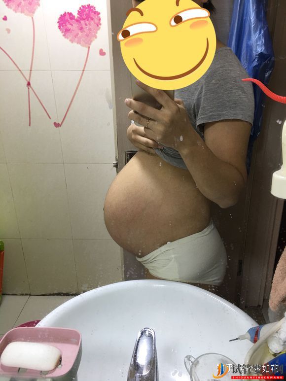 認真臉我覺得泰國試管技術真的不錯(圖3) 認真臉我覺得泰國試管技術真的不錯(圖3)