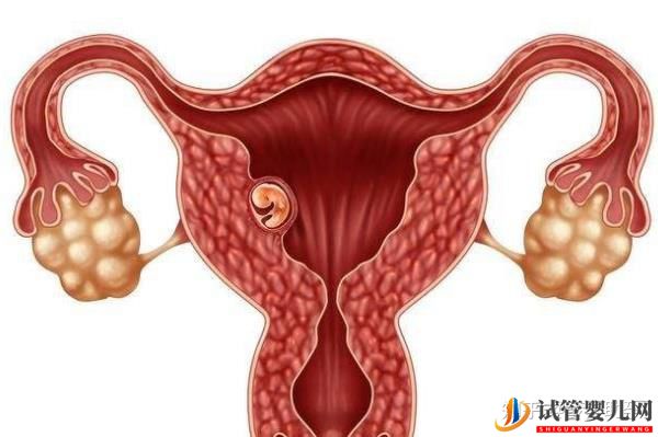 美國試管嬰兒專家如何避免胎停育的發(fā)生(試管嬰兒多少錢)(圖9) 美國試管嬰兒專家如何避免胎停育的發(fā)生(圖5)