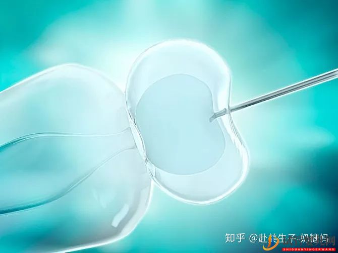 美國試管嬰兒各環節時間安排,整個流程需要多少天(圖1)