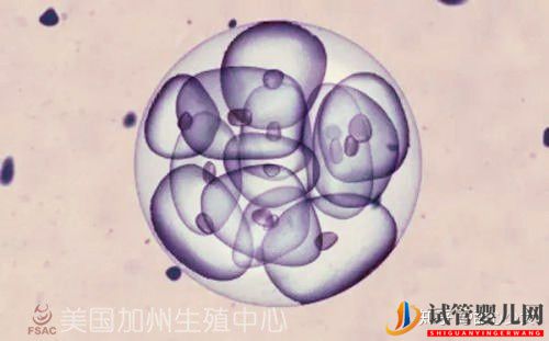 美國試管嬰兒指南如何科學提高成功率(試管嬰兒多少錢)(圖5) 美國試管嬰兒指南如何科學提高成功率(圖3)