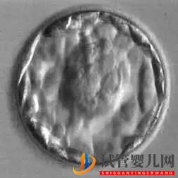 美國試管嬰兒這樣的囊胚才是極好的!(試管嬰兒多少錢)(圖19) 美國試管嬰兒這樣的囊胚才是極好的!(圖10)