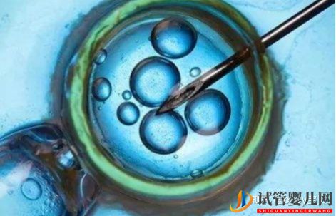 三代試管包生男孩價(jià)格-選男孩多少錢試管大約多少錢(圖1)