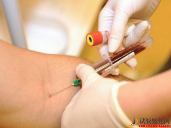 amh0.17自然懷孕難度不小(圖1)