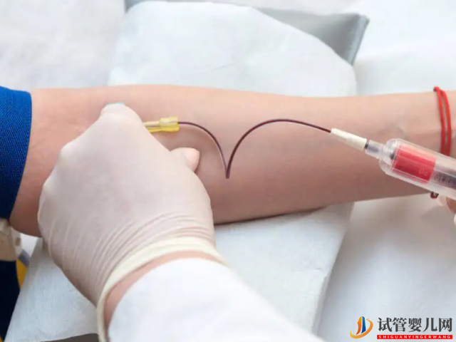 優生優育十項檢查項目匯總(圖1) 優生優育十項檢查項目匯總(圖1)