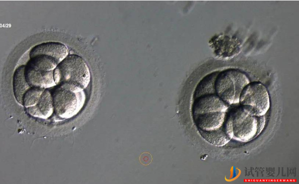 2pn胚胎是不是優質胚胎？移植成功率說明了一切(圖1)