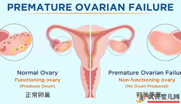 卵巢功能不好也可做試管!成功經(jīng)驗講述如何把影響縮小(圖1) 卵巢功能不好也可做試管!成功經(jīng)驗講述如何把影響縮小(圖1)