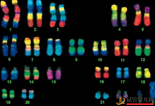 4號(hào)染色體異常的后果 - 缺失綜合征、三體重復(fù)的原因分析(圖2)