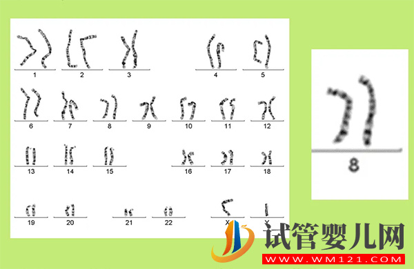 8號染色體異常會怎樣 偏多、缺失、三體是什么原因(圖1)