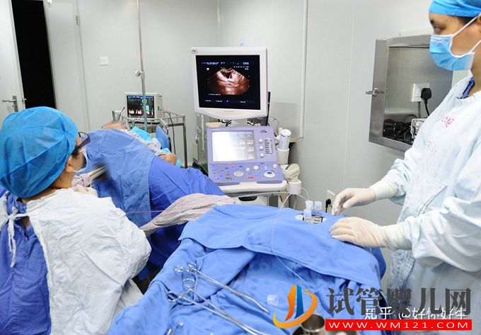 什么是試管嬰兒簡單6步,了解最詳細的步驟(圖2)