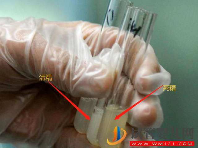 男性死精和活精差異盤點,一張圖帶你兩者表面區別(圖1) 男性死精和活精差異盤點,一張圖帶你兩者表面區別(圖1)