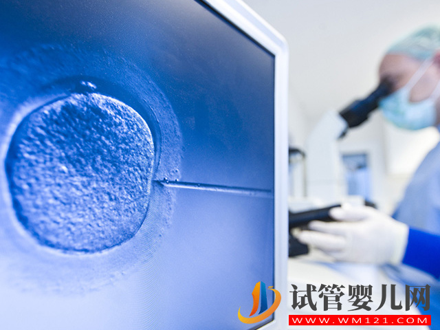 雙腔取卵與單腔取卵區別很大，這3種情況必須雙腔取卵(圖1)