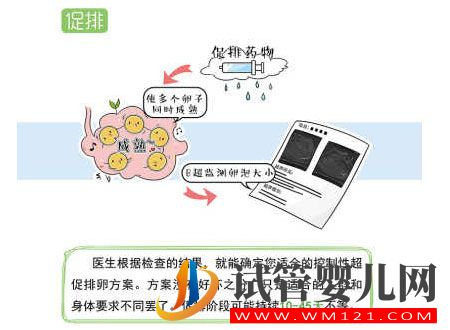 試管嬰兒流程步驟說明 試管嬰兒流程步驟說明(圖3)