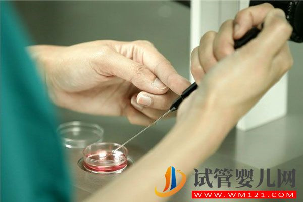 試管嬰兒流程步驟說明 試管嬰兒流程步驟說明(圖5)