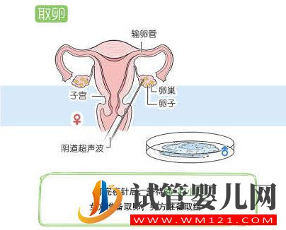 試管嬰兒流程步驟說明 試管嬰兒流程步驟說明(圖7)